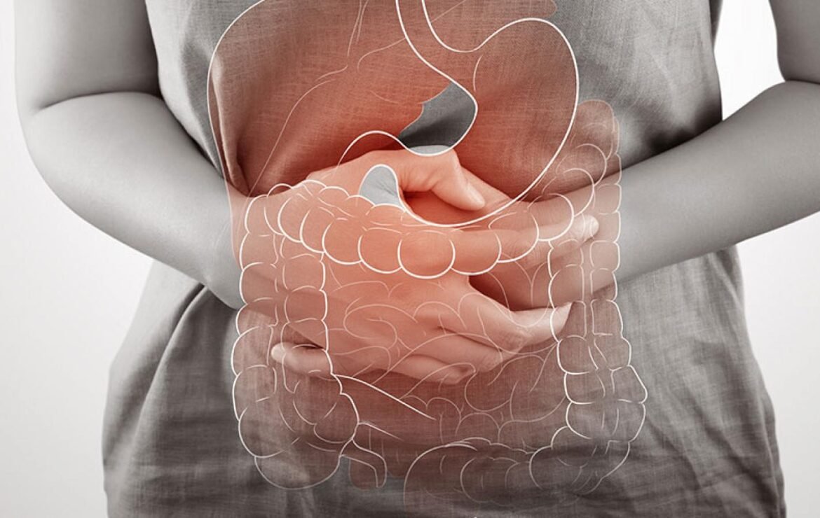 Ülseratif Kolit ve Tıbbi Beslenme Uygulamaları: Hastalığın Yönetiminde Bütüncül Bir Yaklaşım