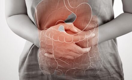 Ülseratif Kolit ve Tıbbi Beslenme Uygulamaları: Hastalığın Yönetiminde Bütüncül Bir Yaklaşım